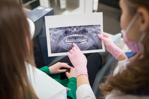 Early Treatment of Orthodontics at Newton