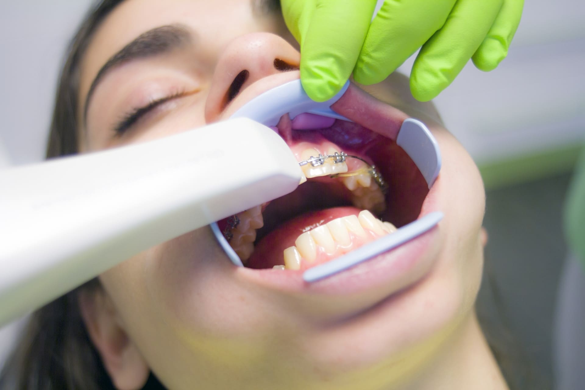 A person receiving dental braces at Waban Dental Group in Newton, MA.