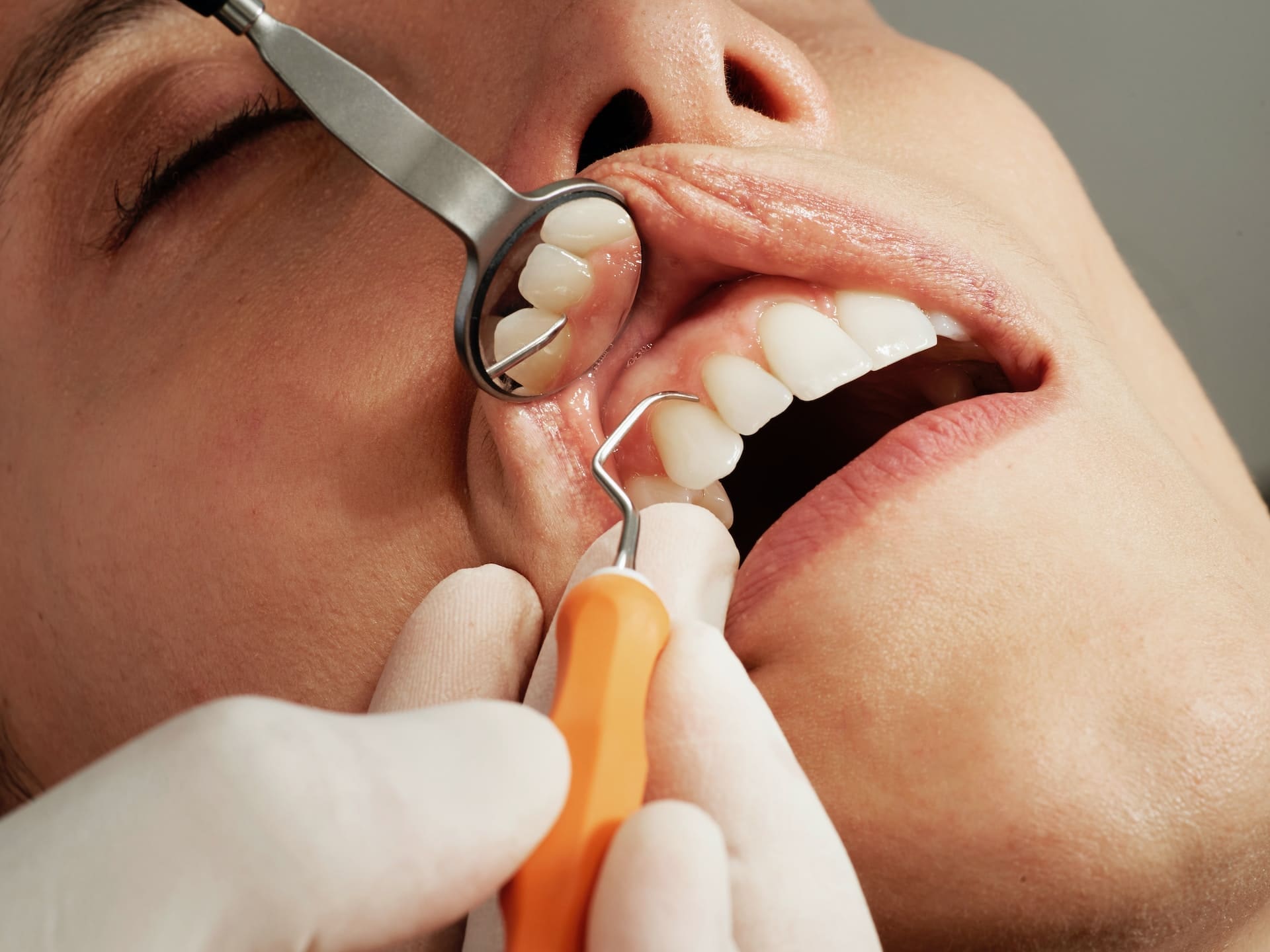 A patient discussing dental implants as a solution for missing teeth with their dentist, showcasing a model of an implant.