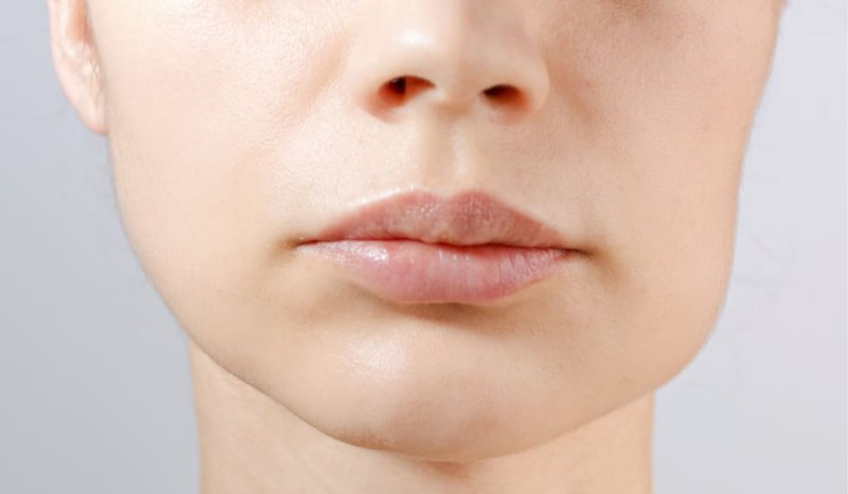 A closeup of a woman with facial swelling