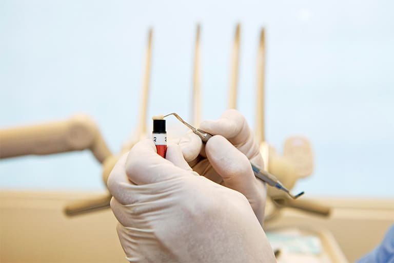 A dentist removing some composite resin from a tube.