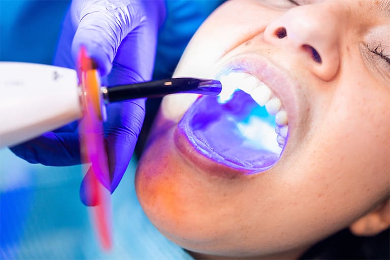 A young patient receiving a tooth-colored filling at the dental office.