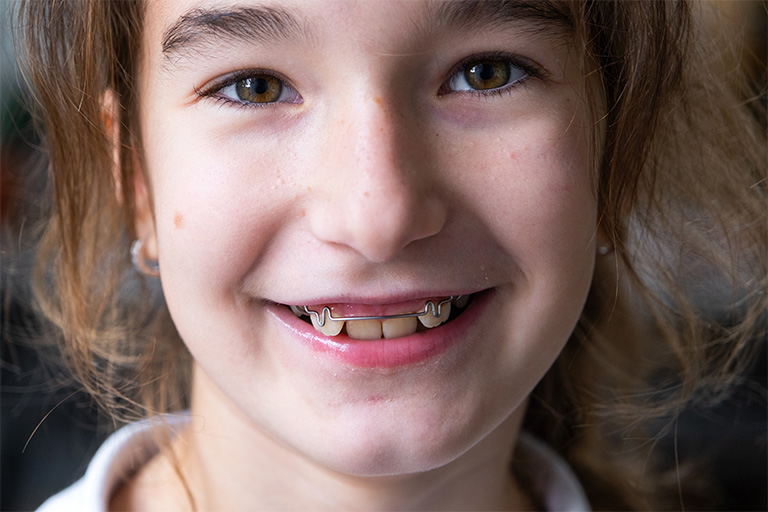 Little girl wearing metal appliances.