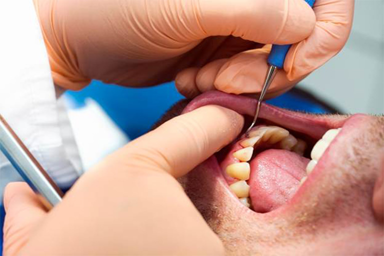 Dentist treating patient with gum disease.