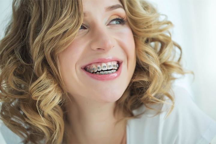 Lady smiles with braces.