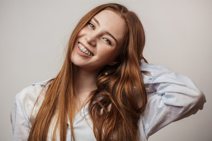 Lady smiles with braces.