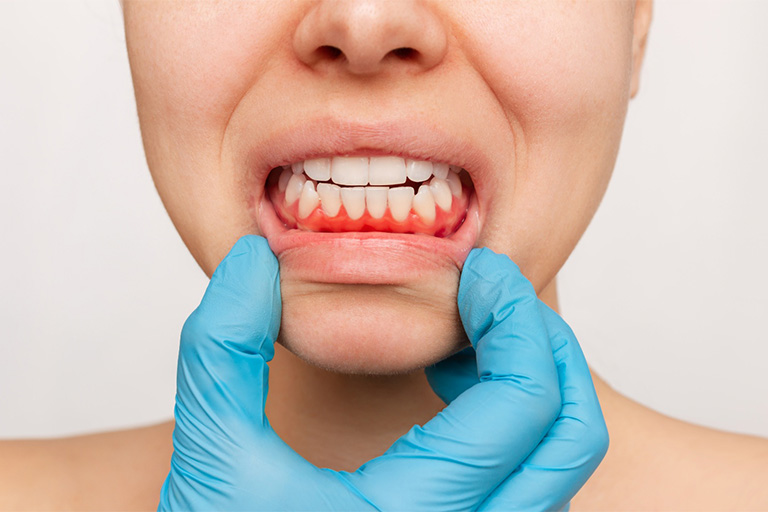 Person needing gum disease treatment in Newton.